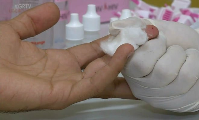 Teste rápido para detectar o HIV pode ser feito gratuitamente — Foto: Reprodução / TV Grande Rio 