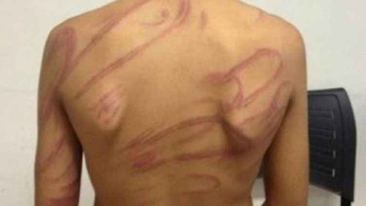 Foto: Reprodução